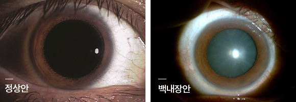 20년 경력 - 세계적 수준의 전문 의료진 : 원칙과 신념을 지키는 대학병원 교수 출신 중심의 전문 의료진들이 각 분야 수술 노하우와 경험으로 최고의 의료서비스를 제공합니다.